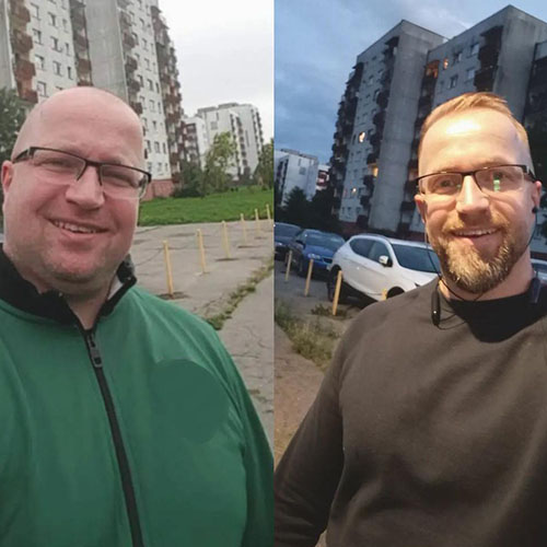 Transformations: Keto diet Before and After 19 Keto Diet Transformations - Kacik