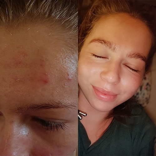 Transformations: Keto diet Before and After 11 Keto Dieta Transformacja Monika